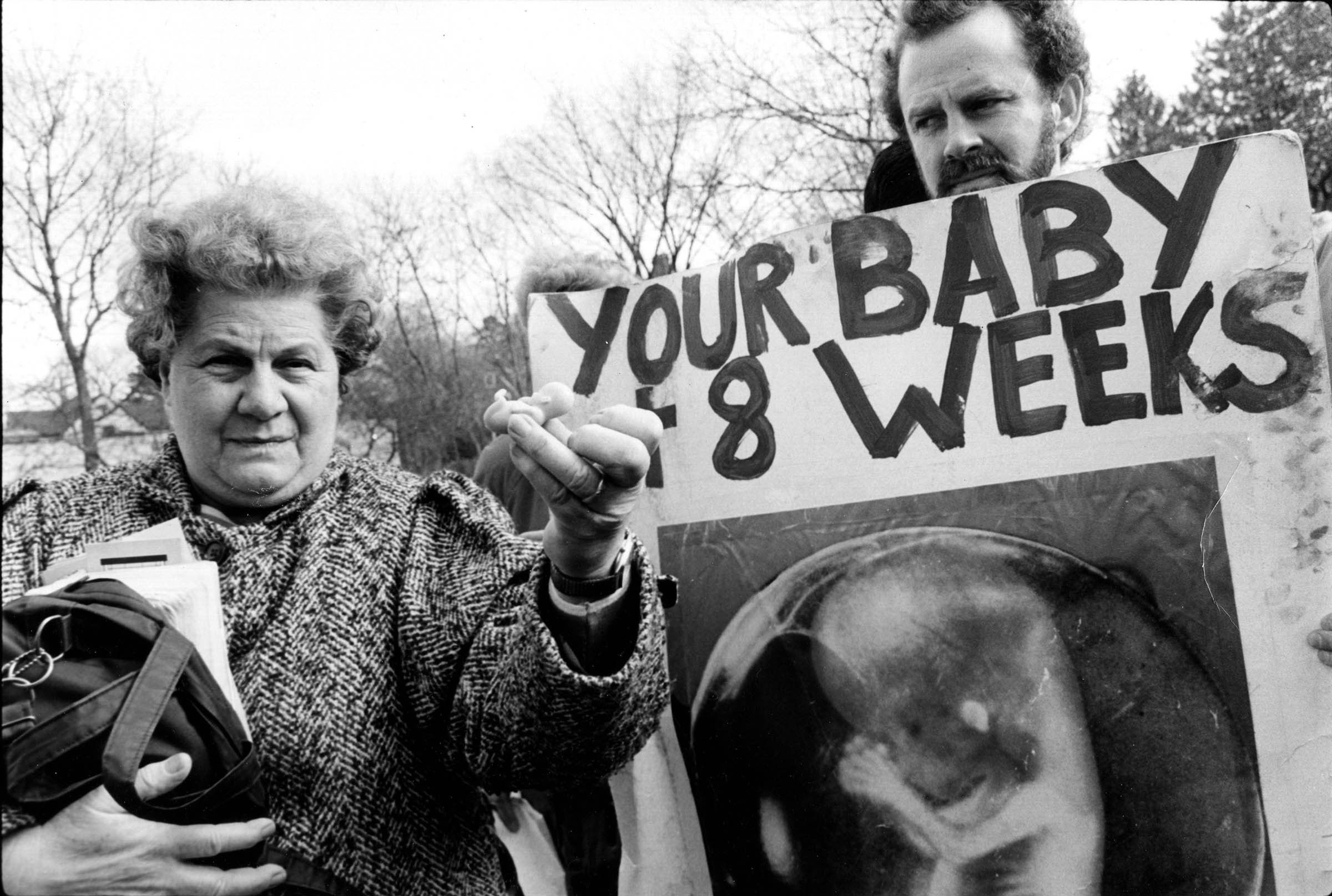 An antiabortion demonstrator brandishes a plastic replica of a fetus during a protest outside a New Jersey abortion clinic in February 1990. Pictures played a significant role in promotion of the “pro-life” cause, reducing a complex debate over women’s rights and the development of life into a single figure, “the unborn child.” Ignoring developmental stages in the womb, they presented images that either depicted full-term, babylike “fetuses” (such as the plastic doll shown here) or focused on the most developed parts of the fetal anatomy (such as the head, hands, and feet) while avoiding those that were less identifiably “human.”