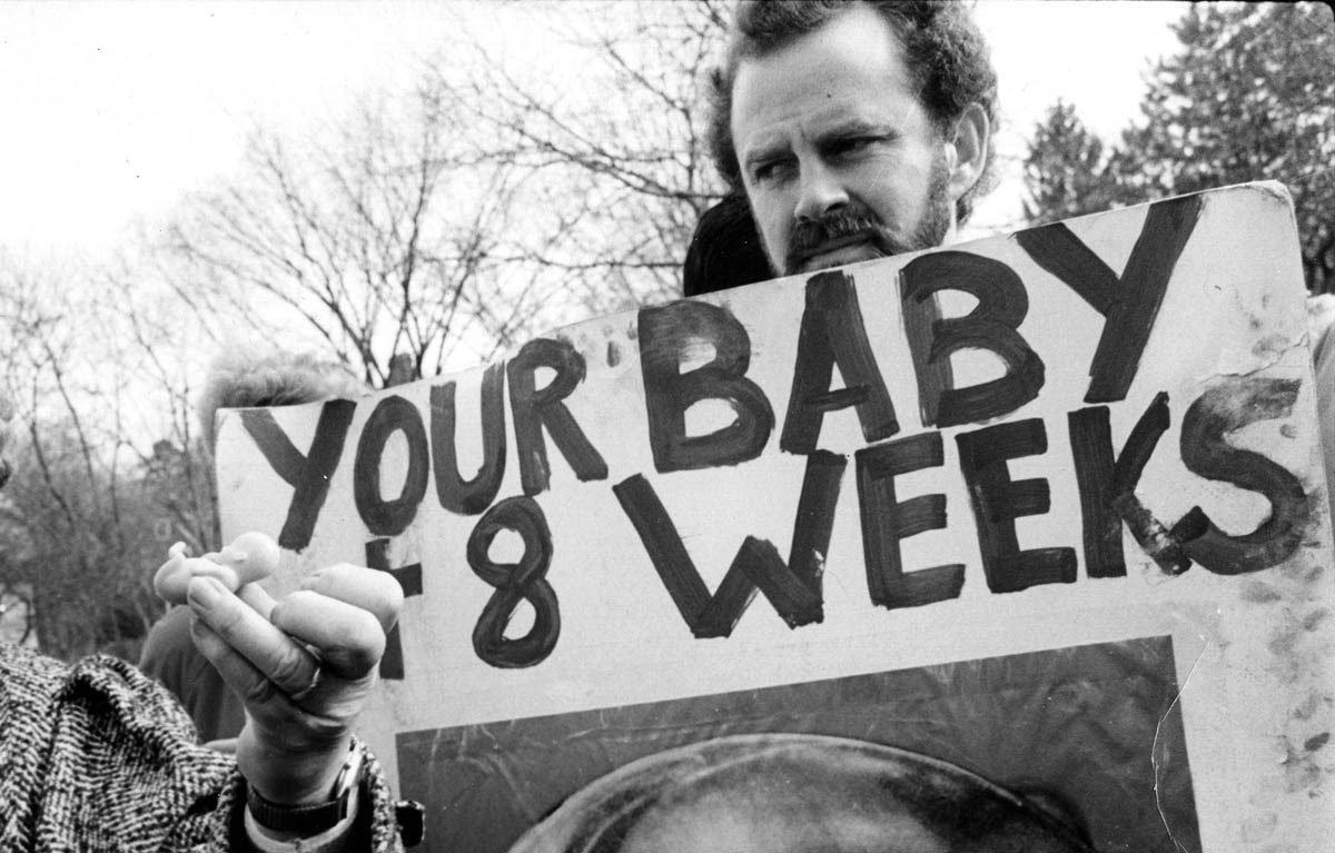 An antiabortion demonstrator brandishes a plastic replica of a fetus during a protest outside a New Jersey abortion clinic in February 1990. Pictures played a significant role in promotion of the “pro-life” cause, reducing a complex debate over women’s rights and the development of life into a single figure, “the unborn child.” Ignoring developmental stages in the womb, they presented images that either depicted full-term, babylike “fetuses” (such as the plastic doll shown here) or focused on the most developed parts of the fetal anatomy (such as the head, hands, and feet) while avoiding those that were less identifiably “human.”