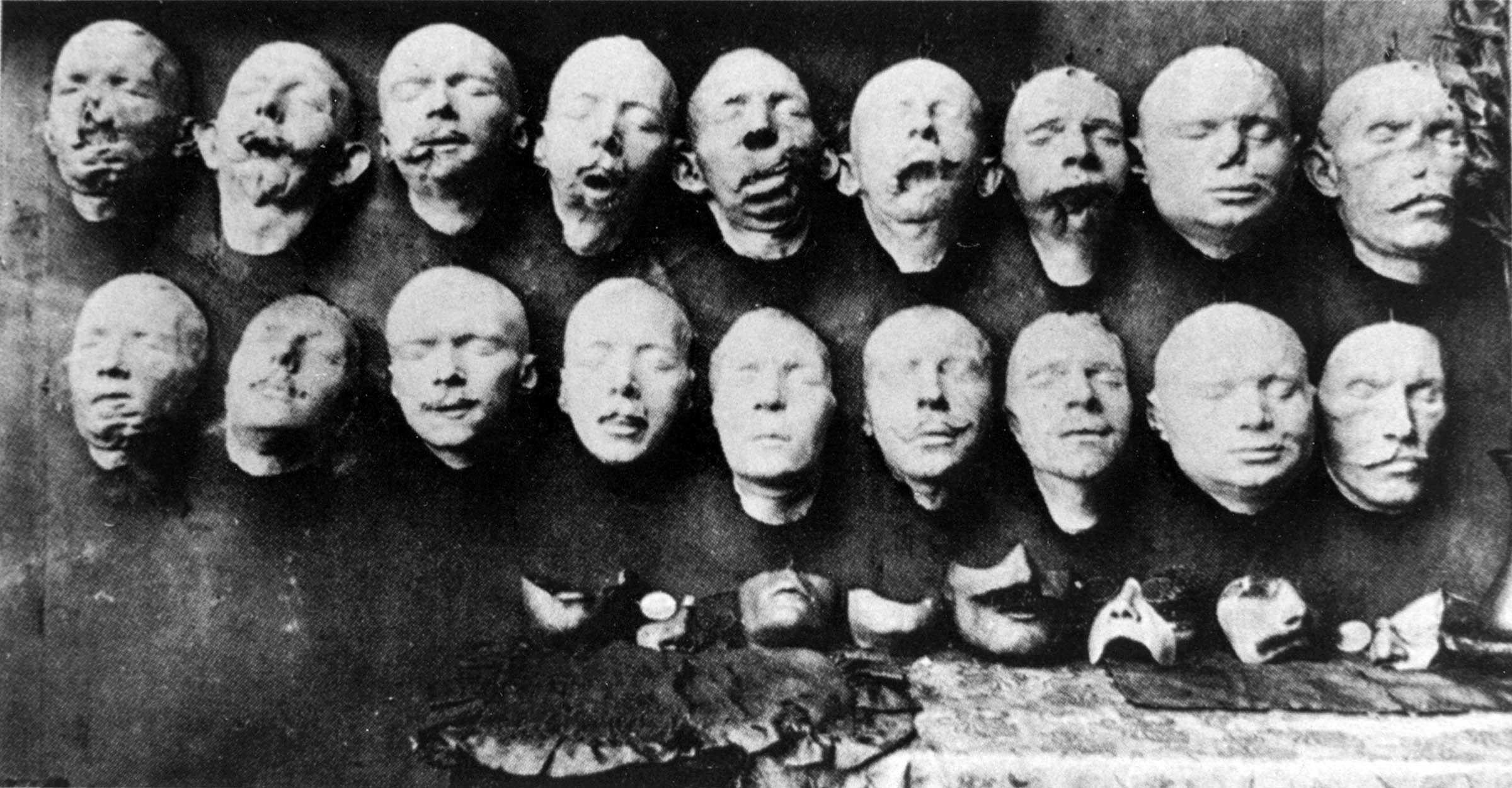 This display of plaster casts showed soldiers’ mutilated faces (top row) and their reconstructions with the aid of new prosthetic devices (bottom row). In spite of its original purpose, the display now serves as a reminder of the damage inflicted on those who fought in World War I and the imperfect attempts to contend with those gruesome effects.